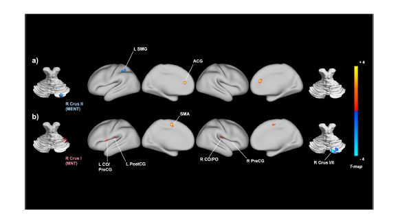 ct deep release based working group