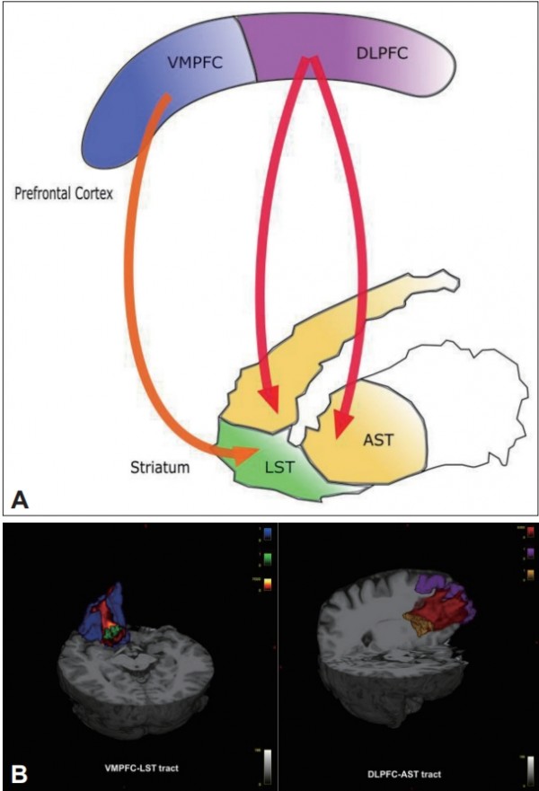 The Relationship Between Frontostriatal Connectivity and Striatal ...