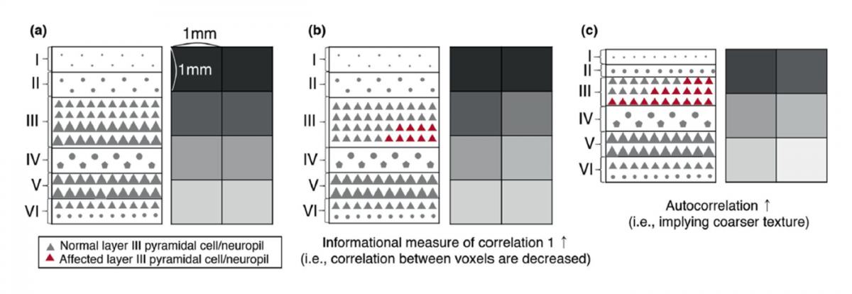 Microstructural changes in cortical layers and MRI texture features